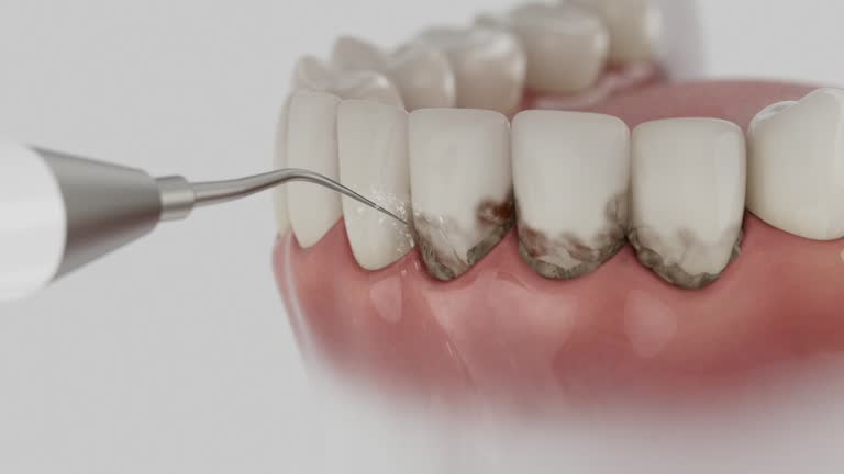 Trusted Dental Crowns And Bridges service in Gallatin, TN - Dentist Open Now